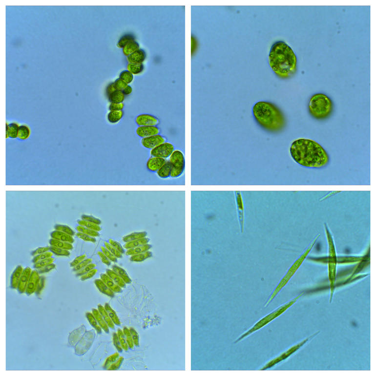 Montasje av forskjellige mikroalger som lever i ferskvann, og som er undersøkt i doktorgradsarbeidet til Ikumi Umetani